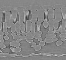 Microcomputed Tomography (microCT)