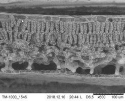 Scanning electron microscopy (SEM)
